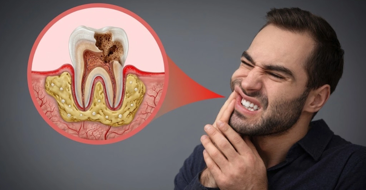 Copper Deficiency and Tooth Damage1